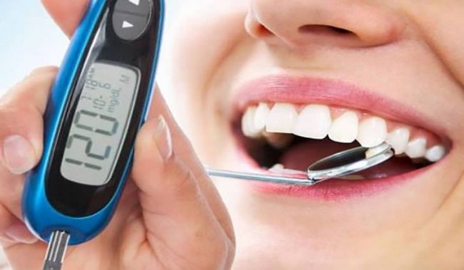 Efermedad periodontal y Diabetes