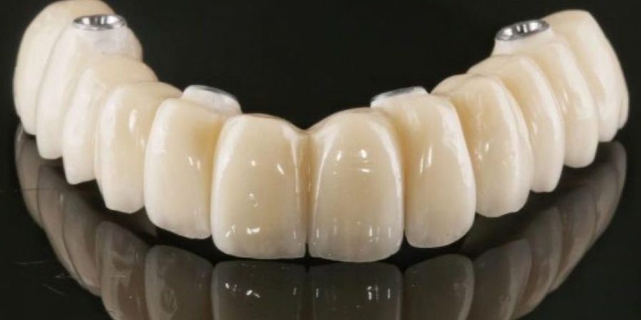 Prótesis de zirconio